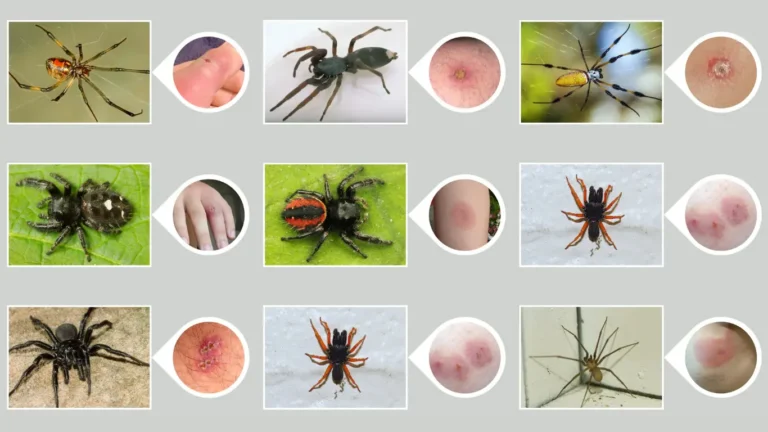37 Types of Spider Bites Identification with Pictures (Symptoms )