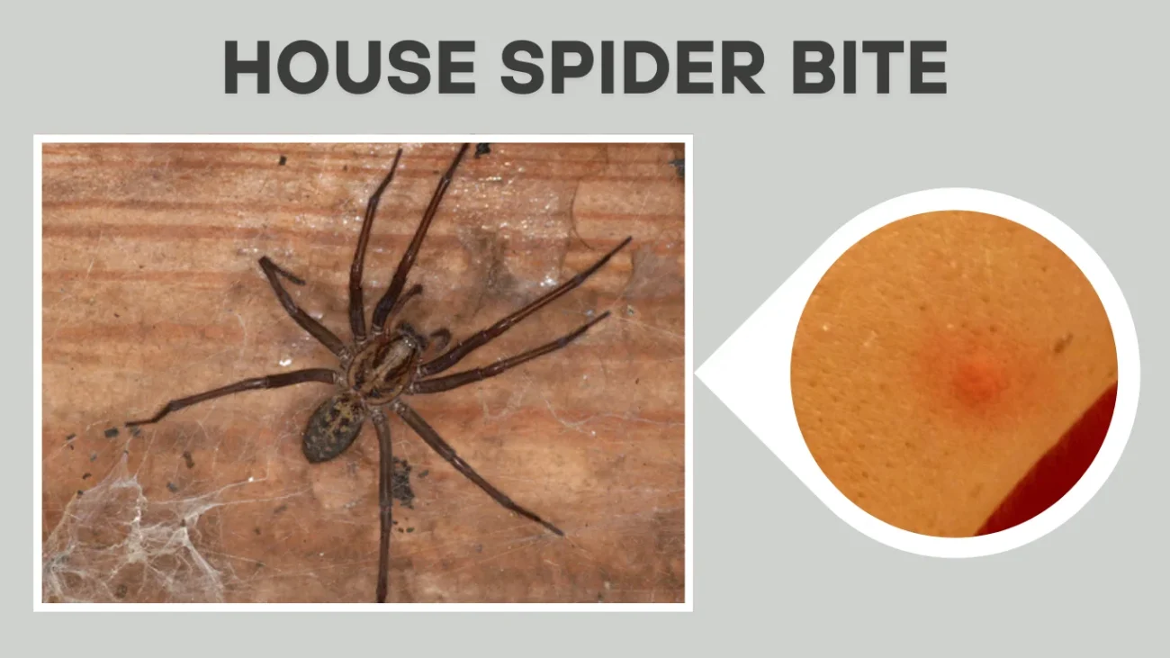 37 Types Of Spider Bites Identification With Pictures Symptoms 