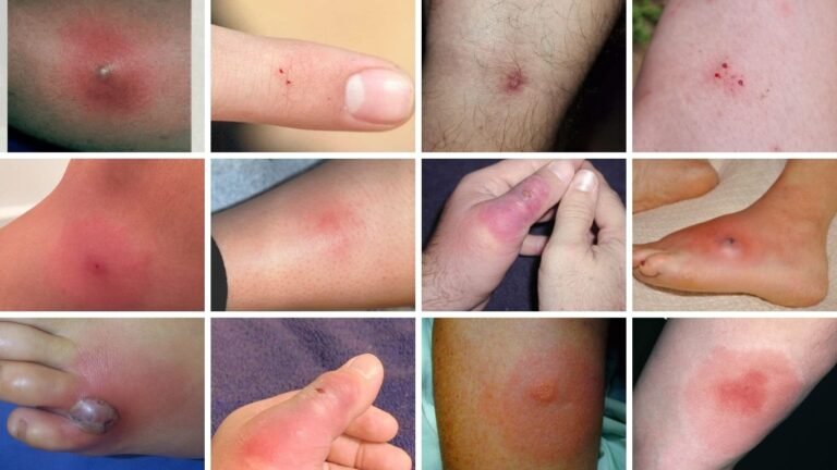 15 Types of Recluse Spiders: Identification, Habits, and Bite Symptoms