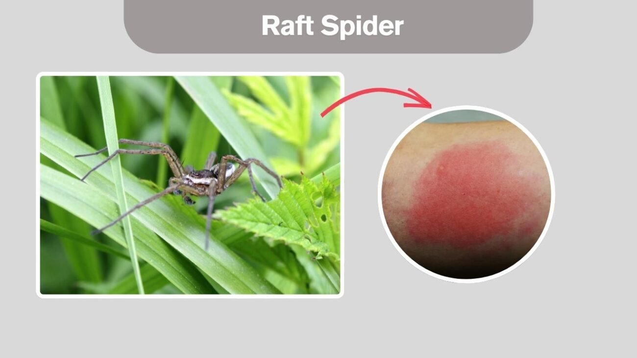 Raft Spider