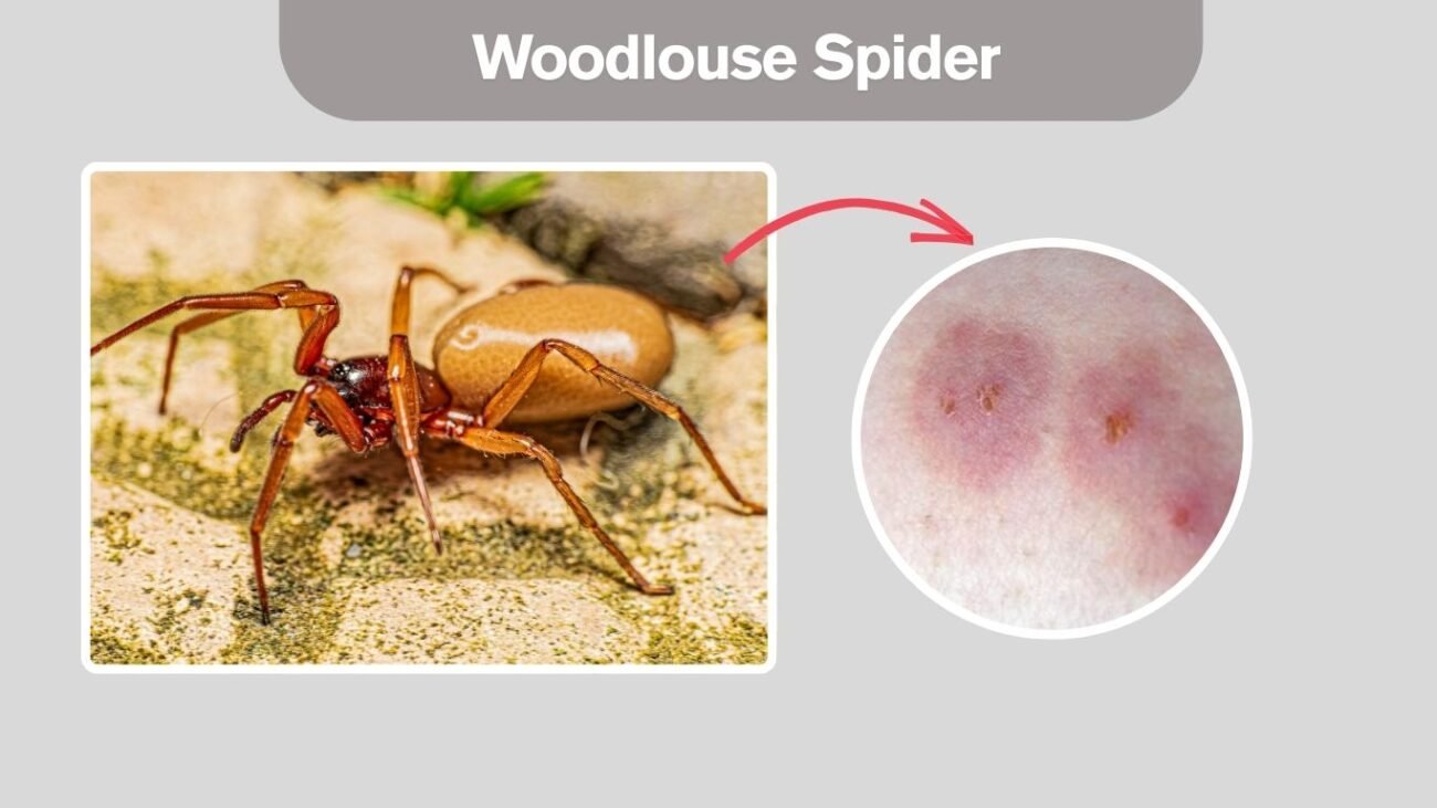 Woodlouse Spider