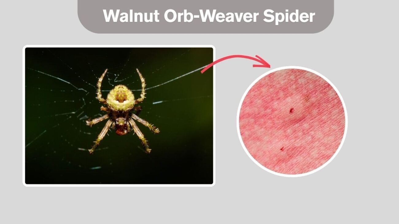 Walnut Orb-Weaver Spider