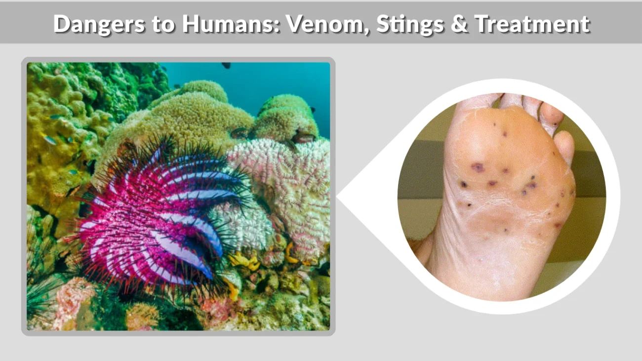 Dangers to Humans Venom, Stings & Treatment