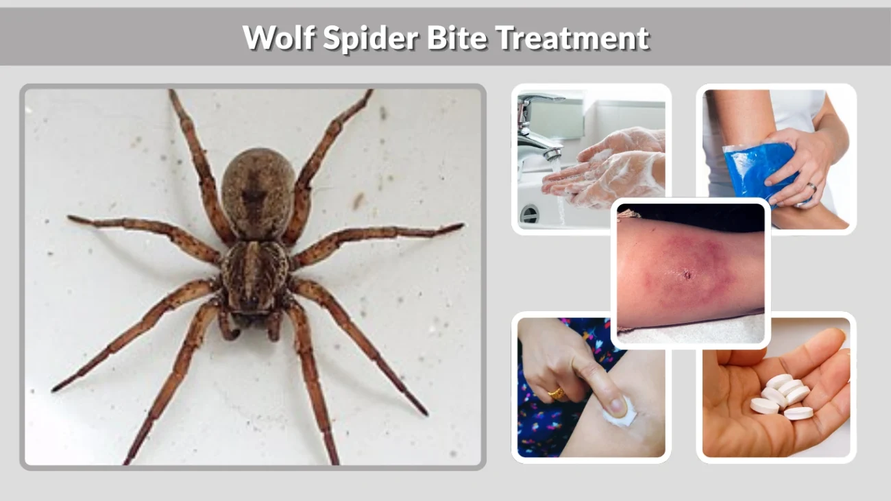 Wolf Spider Bite Treatment