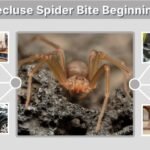 Brown Recluse Spider Bite Beginning Stages: Early Signs