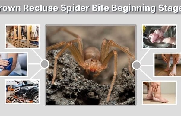 Brown Recluse Spider Bite Beginning Stages: Early Signs