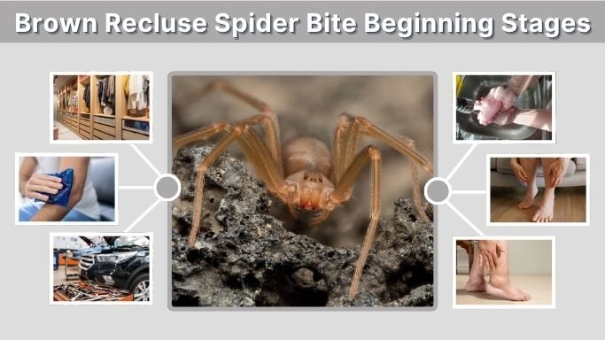 Brown Recluse Spider Bite Beginning Stages: Early Signs