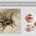 Wolf Spider Bite Symptoms: Early Signs, Risks and Treatment