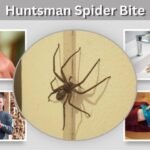 Huntsman Spider Bite: Symptoms, Marks, and Treatment