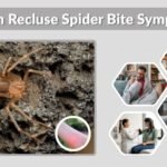 Brown Recluse Spider Bite Symptoms: Timeline and Signs