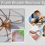 Bites From Brown Recluse Spider: Symptoms and Treatment