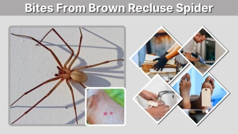 Bites From Brown Recluse Spider: Symptoms and Treatment