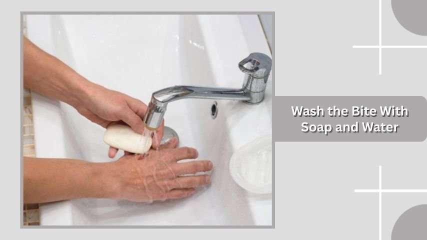 Wash the Bite With Soap and Water