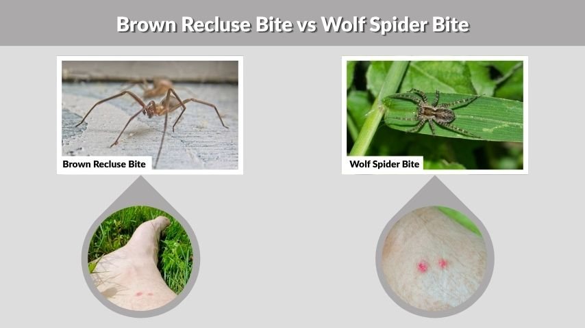 Brown Recluse Bite vs Wolf Spider Bite