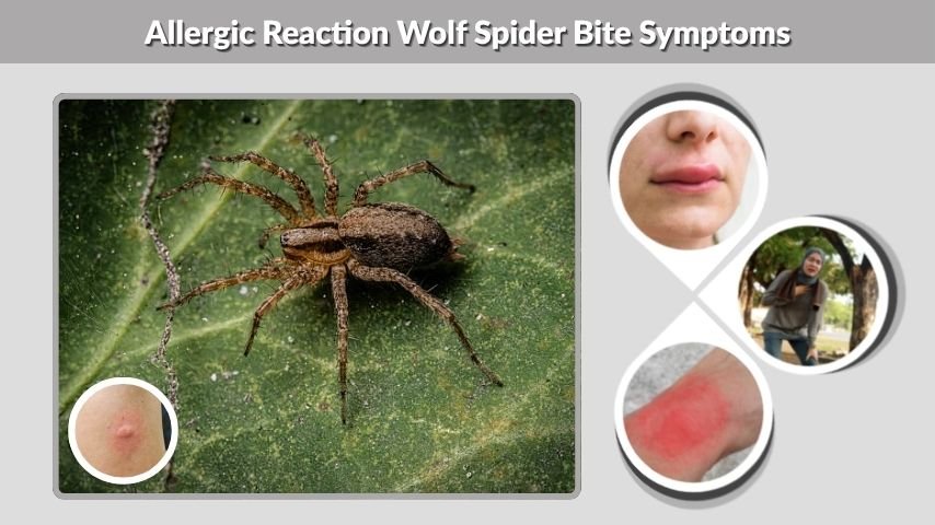 Allergic Reaction Wolf Spider Bite Symptoms