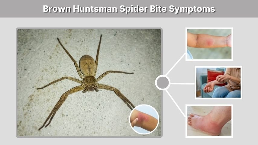 Brown Huntsman Spider Bite Symptoms
