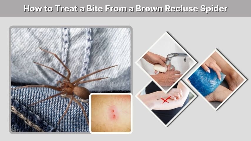 How to Treat a Bite From a Brown Recluse Spider