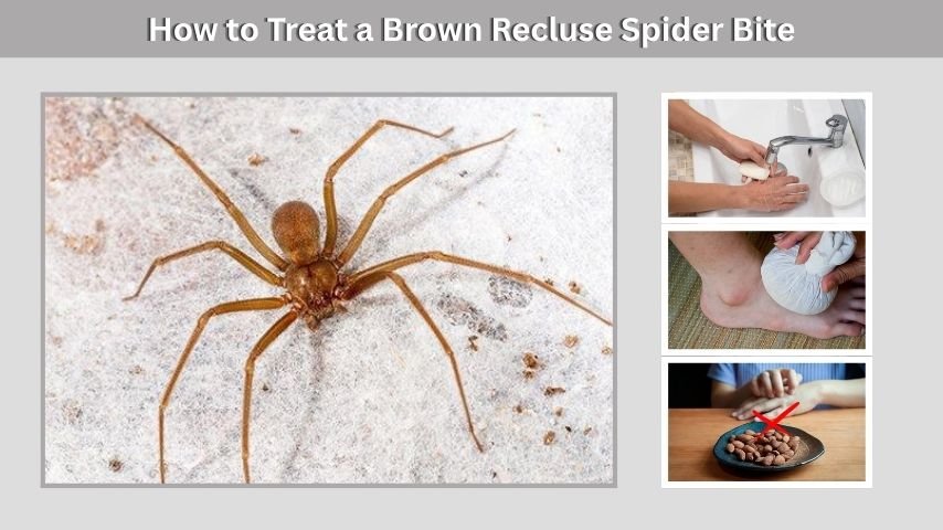 How to Treat a Brown Recluse Spider Bite