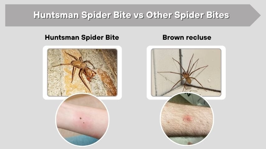 Huntsman Spider Bite vs Other Spider Bites