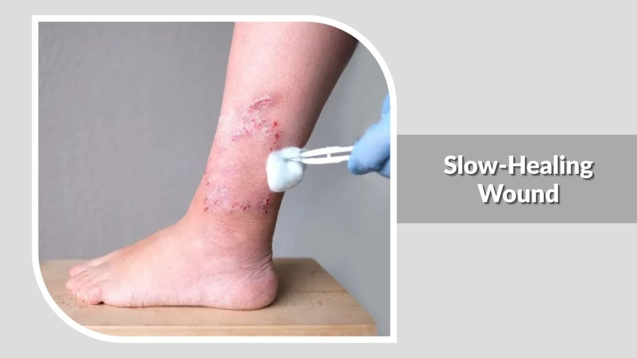 Slow-Healing Wound