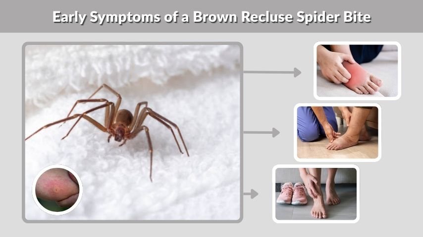Early Symptoms of a Brown Recluse Spider Bite