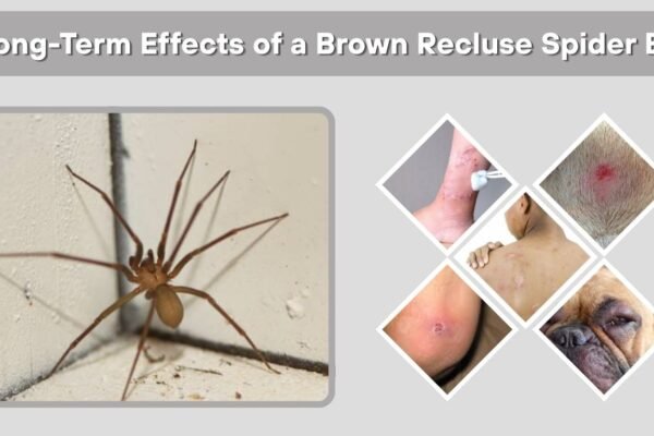7 Long-Term Effects of a Brown Recluse Spider Bite