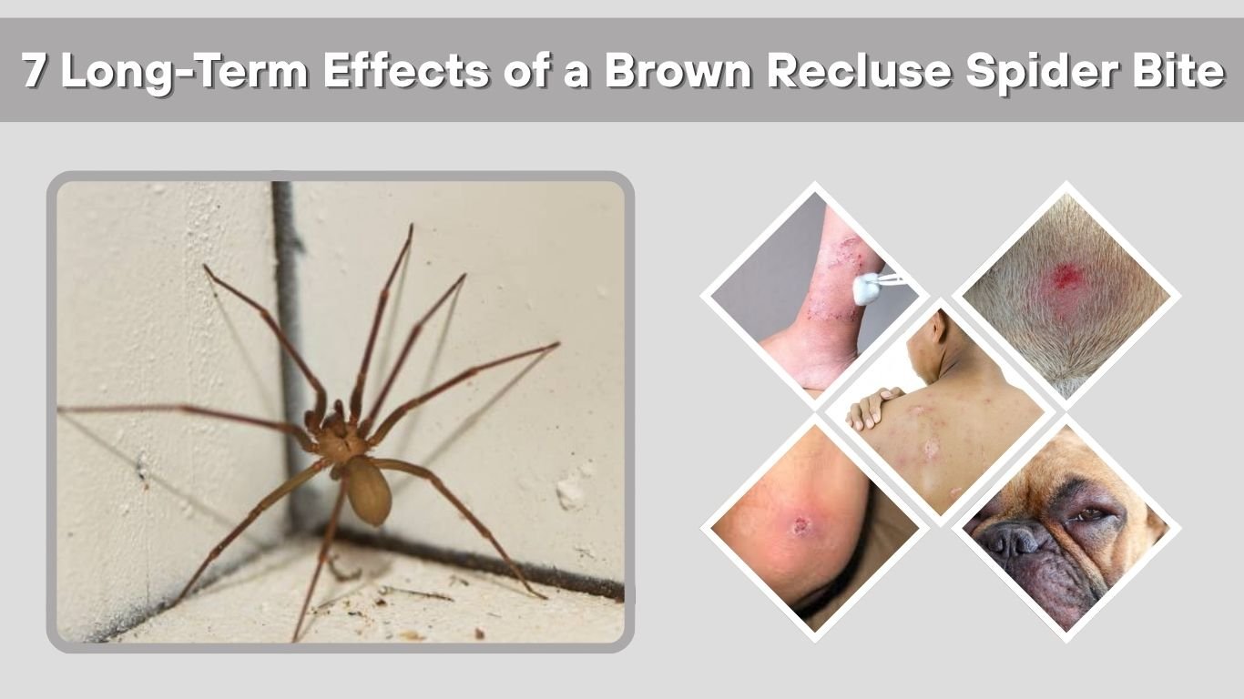 7 Long-Term Effects of a Brown Recluse Spider Bite