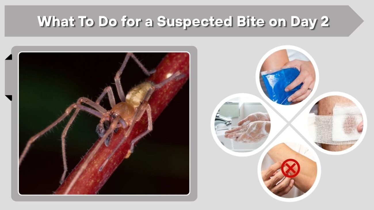 What To Do for a Suspected Bite on Day 2