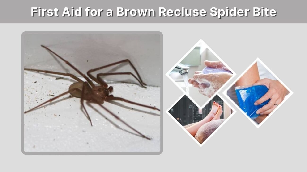 First Aid for a Brown Recluse Spider Bite