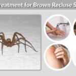 Medical Treatment for Brown Recluse Spider Bite