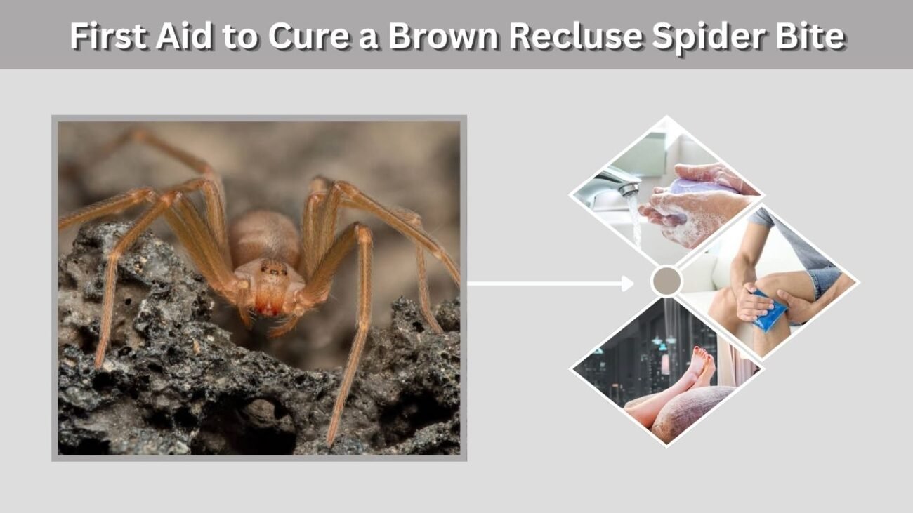 First Aid to Cure a Brown Recluse Spider Bite