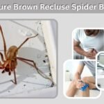 How to Cure Brown Recluse Spider Bite Safely