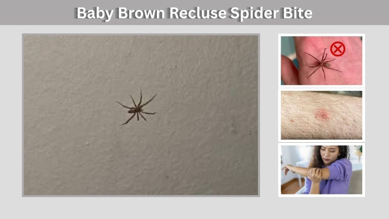 Baby Brown Recluse Spider Bite