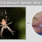 Orb Weaver Spider Bite: Symptoms, Treatment and SafetyOrb Weaver Spider Bite: Symptoms, Treatment and Safety