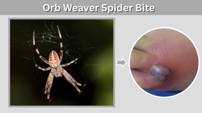 Orb Weaver Spider Bite: Symptoms, Treatment and Safety