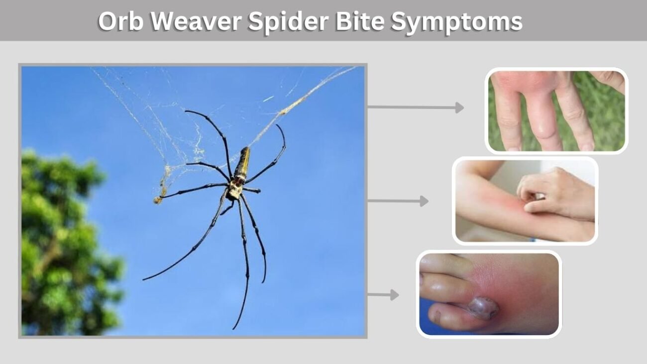 Orb Weaver Spider Bite Symptoms