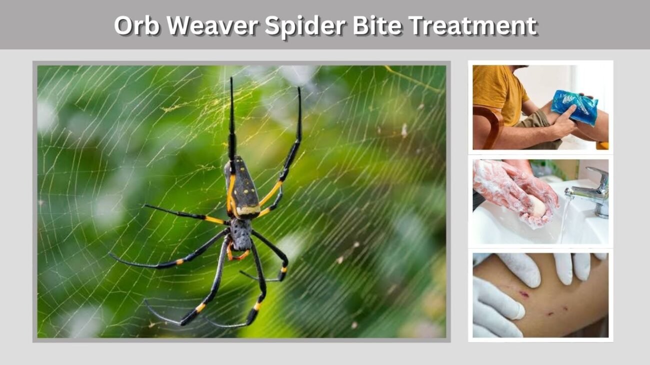 Orb Weaver Spider Bite Treatment