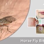 Horse Fly Bite: Symptoms, Treatment and Healing Stages
