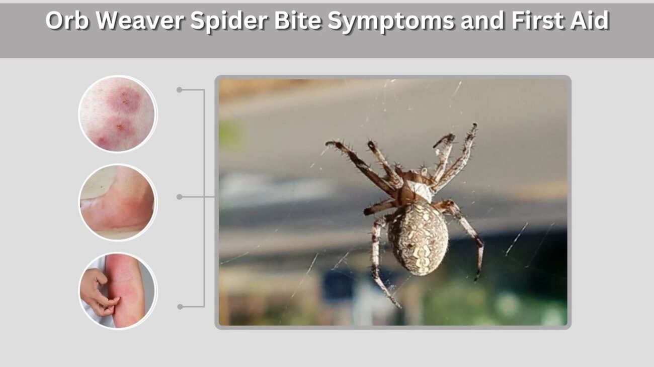 Orb Weaver Spider Bite Symptoms and First Aid