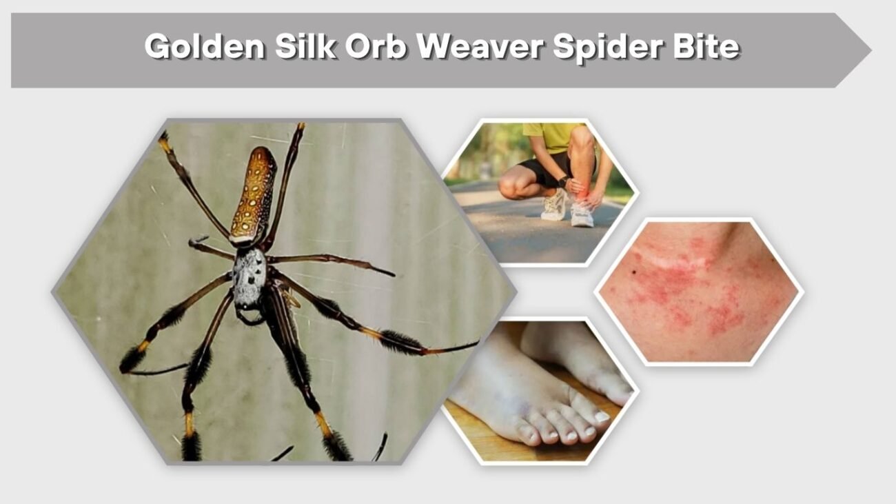 Golden Silk Orb Weaver Spider Bite