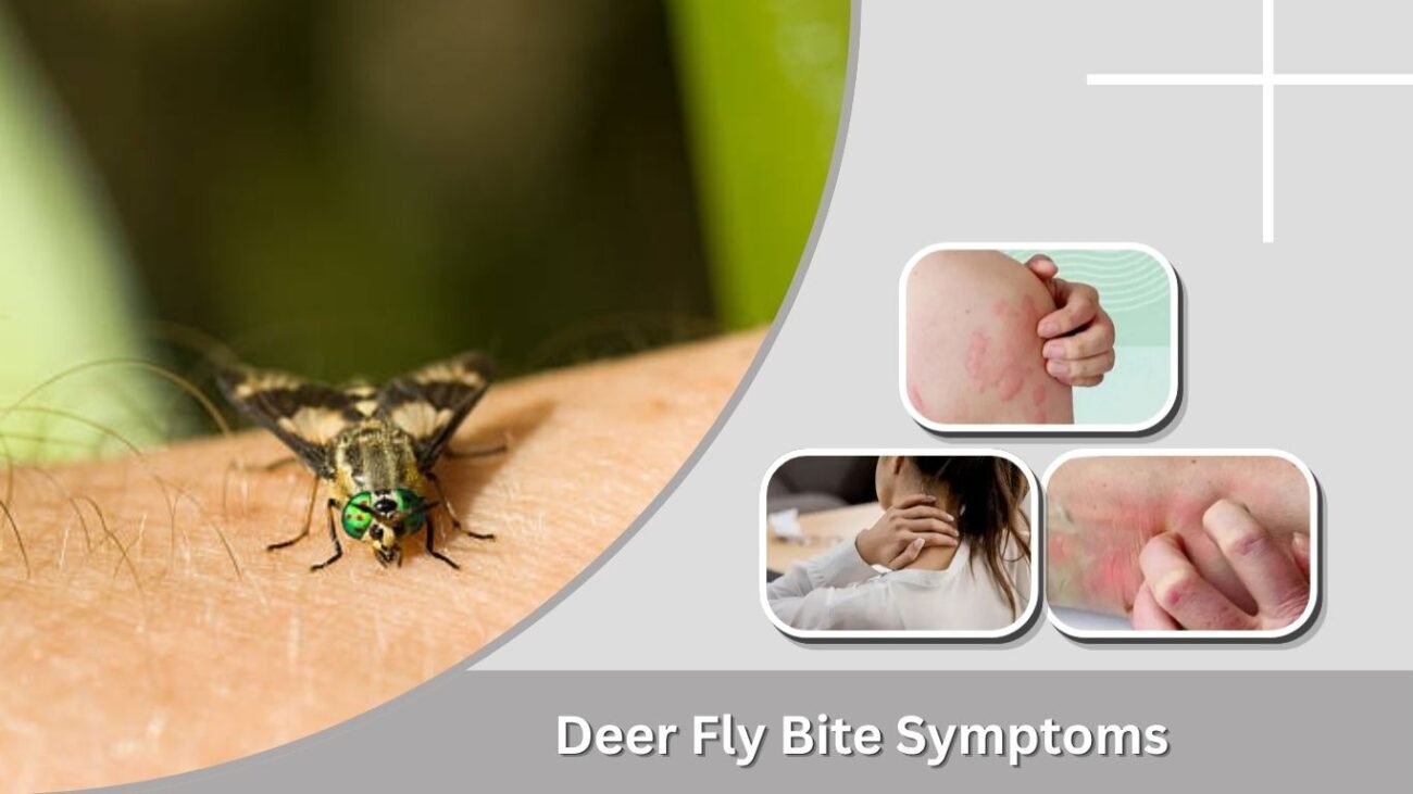 Deer Fly Bite Symptoms