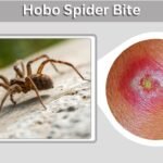 Hobo Spider Bite: Symptoms, Stages, Treatment and Facts