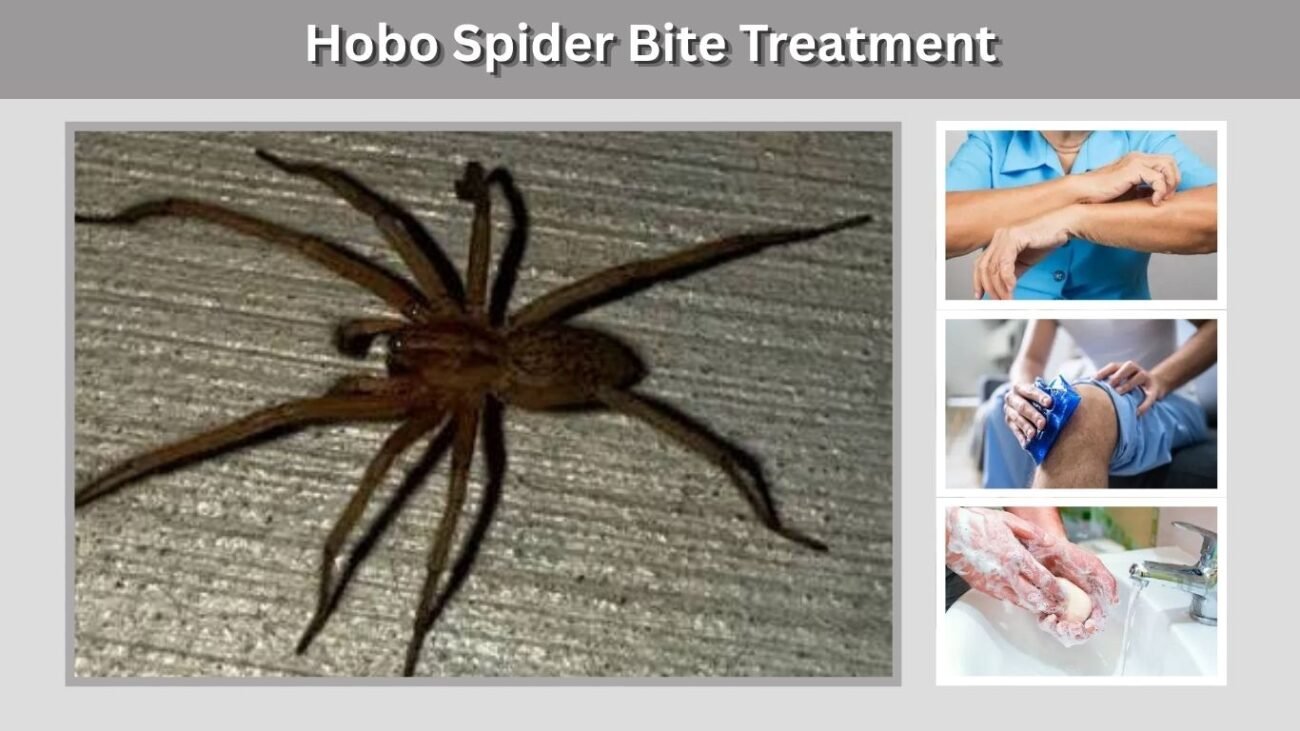 Hobo Spider Bite Treatment