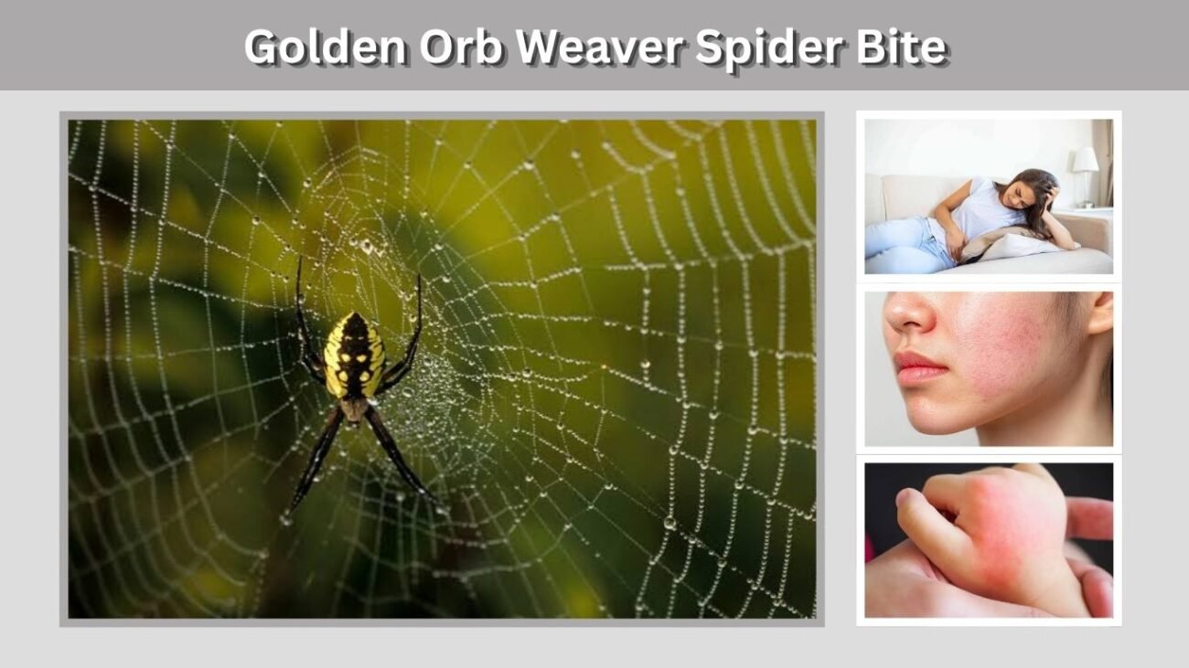 Golden Orb Weaver Spider Bite