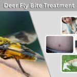 Deer Fly Bite Treatment: Symptoms, Swelling, and Relief