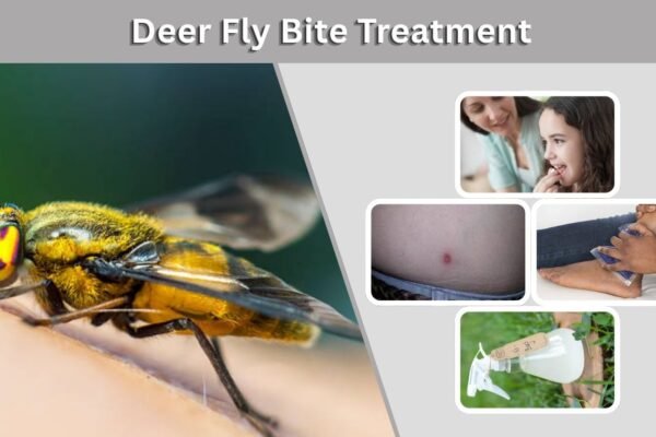 Deer Fly Bite Treatment: Symptoms, Swelling, and Relief