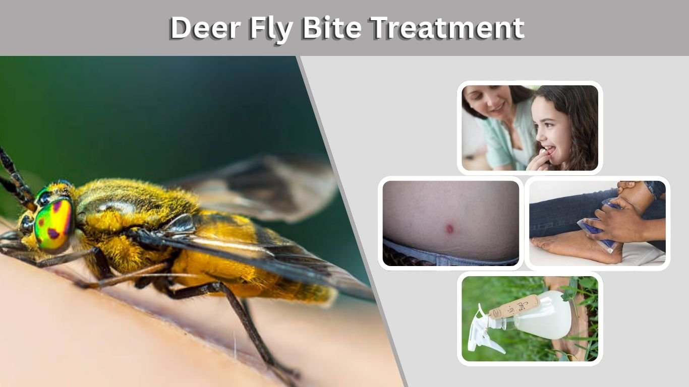 Deer Fly Bite Treatment: Symptoms, Swelling, and Relief