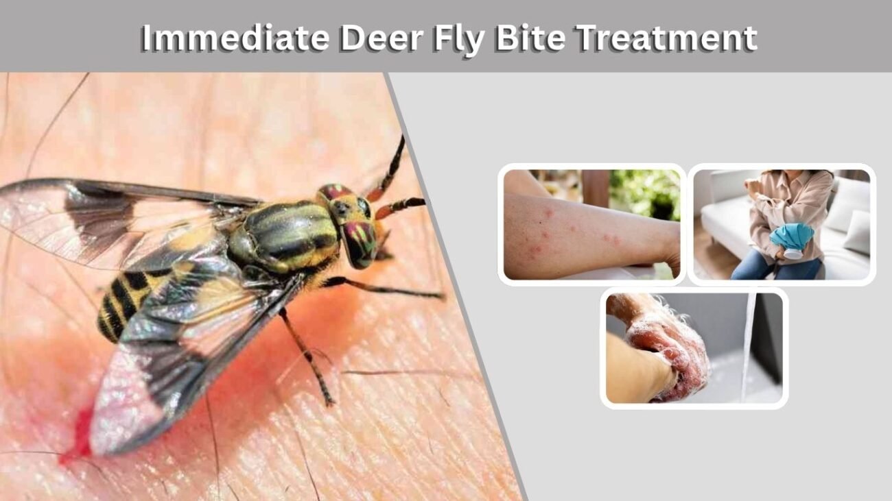 Immediate Deer Fly Bite Treatment