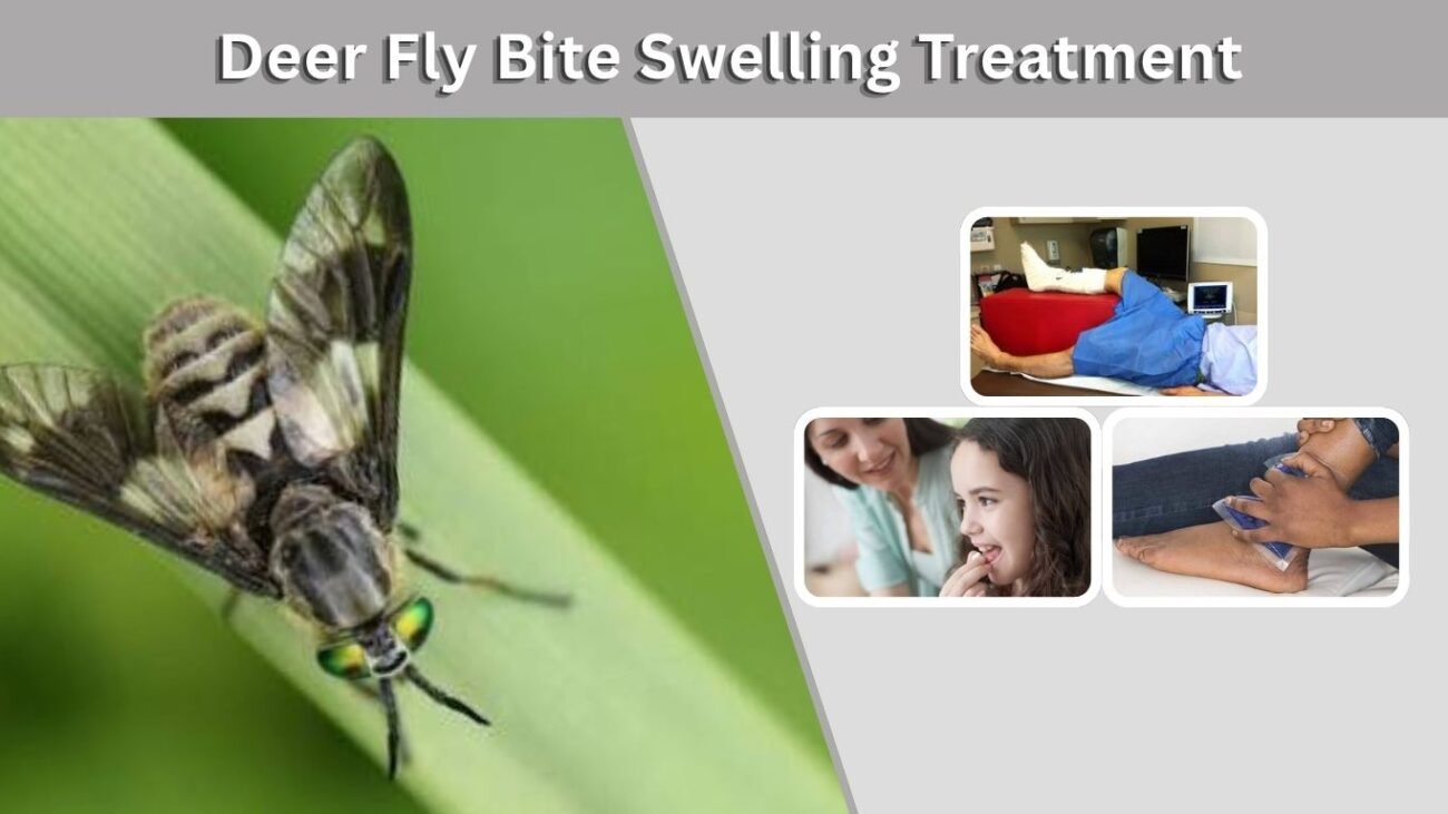Deer Fly Bite Swelling Treatment