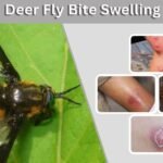 Deer Fly Bite Swelling: Causes, Treatment and Warning Signs
